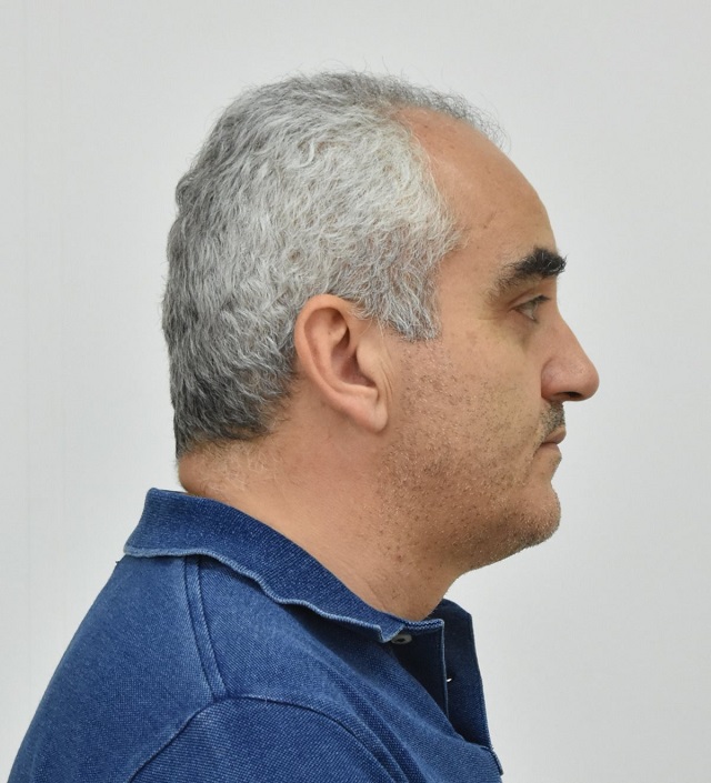 apateon2